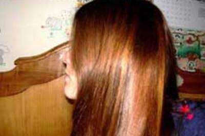 Homeopathy gives hope to patients suffering hair loss