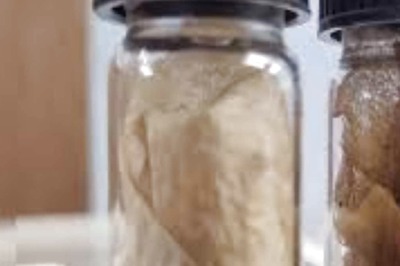 In Bengal, Raiganj University Devises Bandages Made From Silk Cocoon