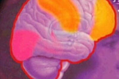 West African meningitis outbreak kills 931: UNICEF