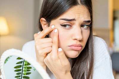 These 4 Tips Can Help You Fight Acne Issues