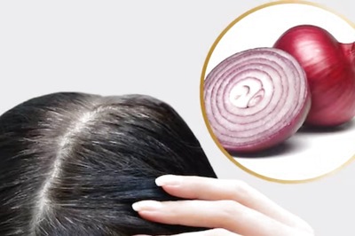 Dried Gooseberries To Onion Juice, Natural Ingredients To Treat Grey Hair