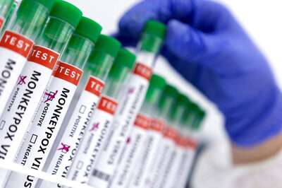 News18 Afternoon Digest: WHO Confirms 780 Cases of Monkeypox Detected Across 27 Countries as of June 2 & Other Stories