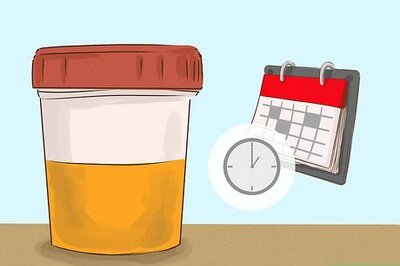 How to Store Urine for a Drug Test