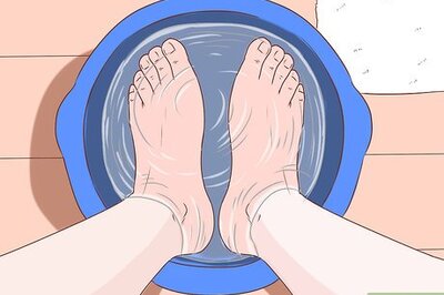 How to Get Rid of Calluses on Feet