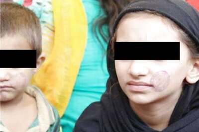 Two Minors Stamped Entry Seal on Faces at Bhopal Central Jail