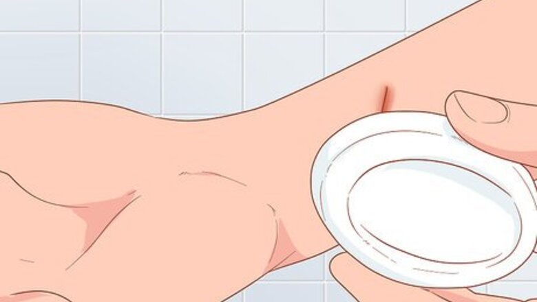 How to Stop a Keloid from Growing