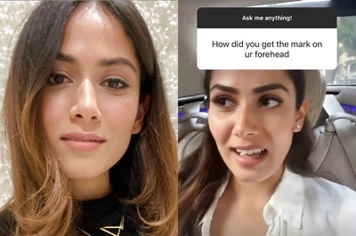 Mira Rajput Kapoor Reveals How She Got a Scar on Her Forehead in Her Childhood