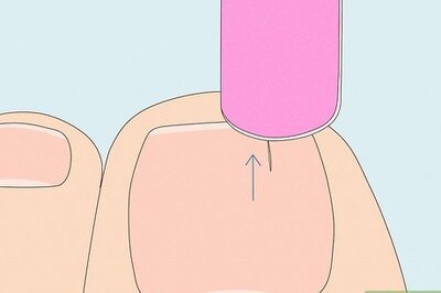 Fixing a Split Toenail: Home Care for Strong Nails