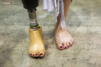 Robotic ankles will soon have 'eyes' to see where they are going