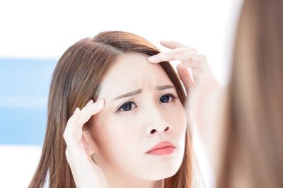 Try These Easy Home Remedies To Get Rid Of Forehead Blackness