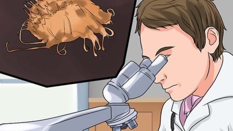 How to Diagnose Scabies