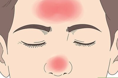 How to Cure Nasal Polyps