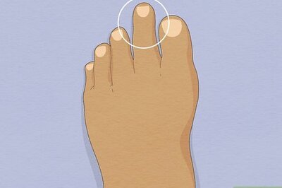 How to Deal With Morton's Toe