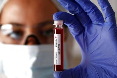 Ex-Himachal Minister Shyama Sharma Passes Away, Covid-19 Positive Report Arrives After Death