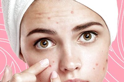 An Ideal PCOS Skincare Routine