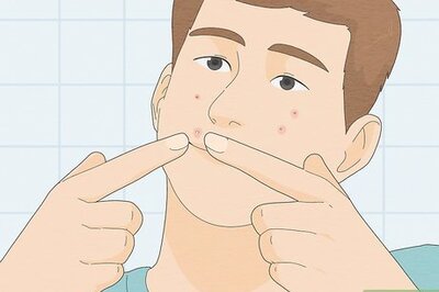 How to Pop a Pimple