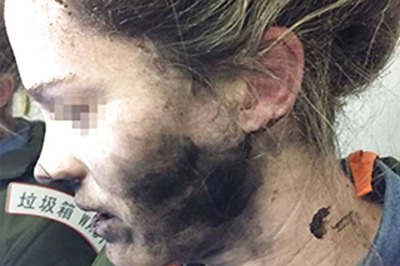 Woman Suffers Burns as Headphones Catch Fire During Flight to Australia