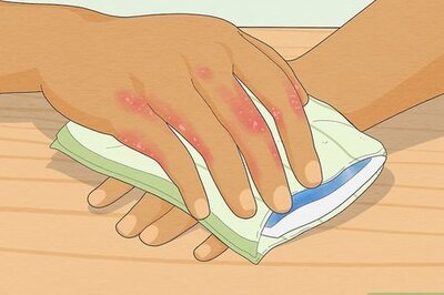The 8 Best Ways to Treat Dyshidrotic Eczema at Home