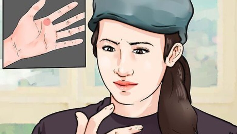 How to Know if You Have Trigger Finger