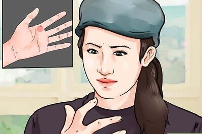 How to Know if You Have Trigger Finger