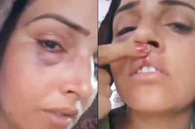 Fact-Check: Truth Behind Seema Haidar's Swollen Eye, Lip Injury in Viral Video. Pak YouTubers' Hand Suspected