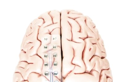 At German Hospital, 34-Year-Old Man Battling ALS Communicates Through Brain Implant