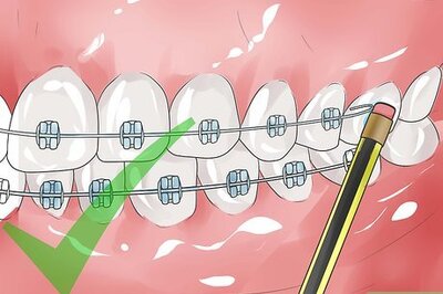 How to Handle Poking Wires on Braces