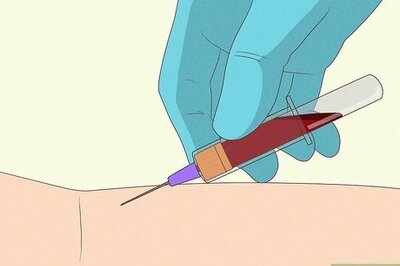 How to Treat Overmethylation