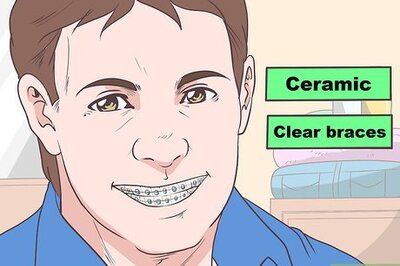 How to Hide Braces