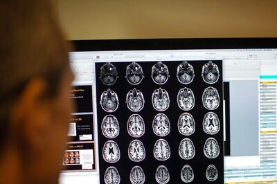 US Regulator Approves Eli Lilly Drug For Early Alzheimer Treatment