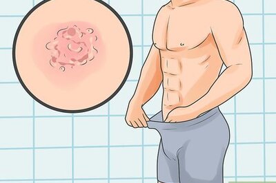 How to Test for Herpes