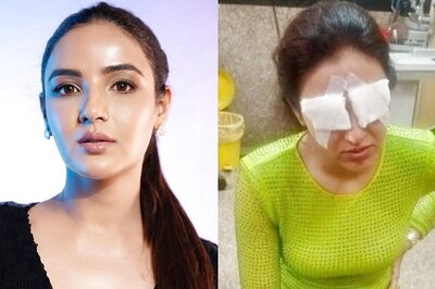 Jasmin Bhasin Is 'Feeling Worst' Due To Corneal Damage, Talks About 'Excruciating Pain and No Vision'