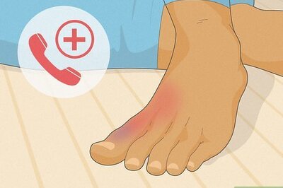 How to Heal a Broken Toe