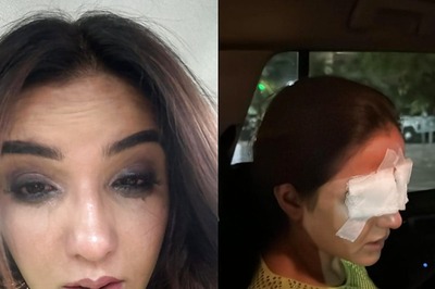 Jasmin Bhasin Shares Update After She Suffers Corneal Damage Due To Lens Mishap: 'Can't See Properly'